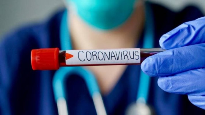 Covid-19: “o pior ainda está por vir”, alerta presidente da Sociedade Brasileira de Virologia